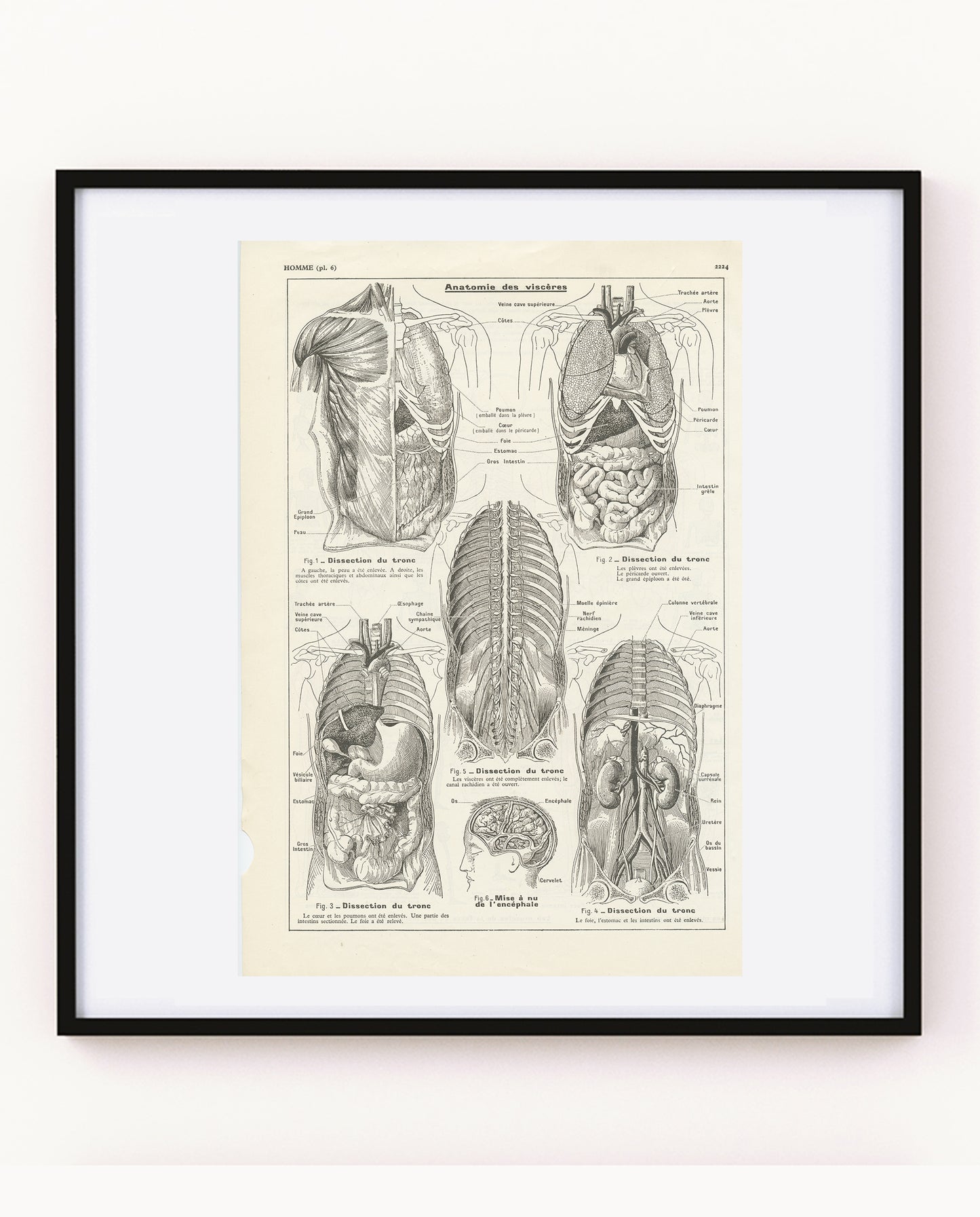 Medical anatomy poster - Viscera / torso