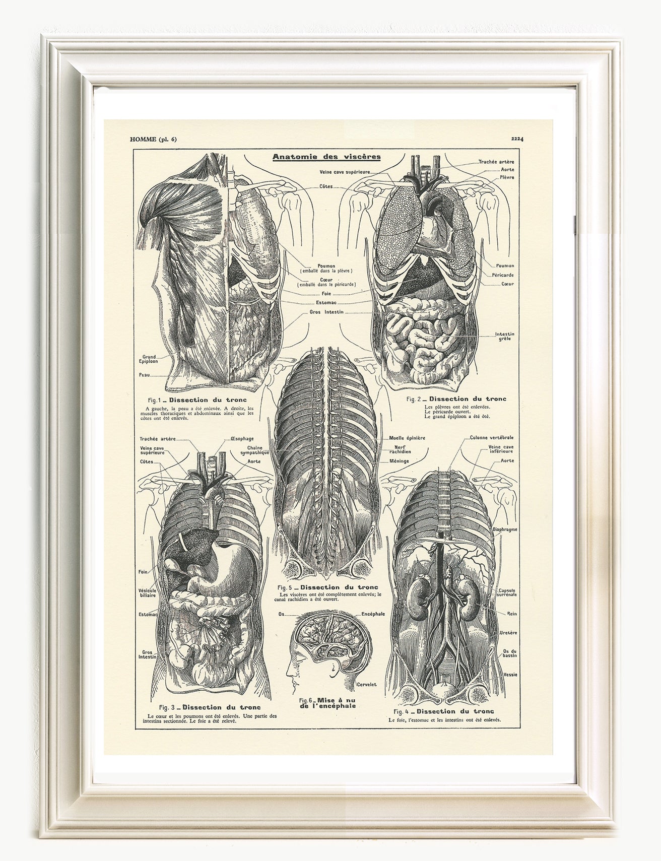 Medical anatomy poster - Viscera / torso