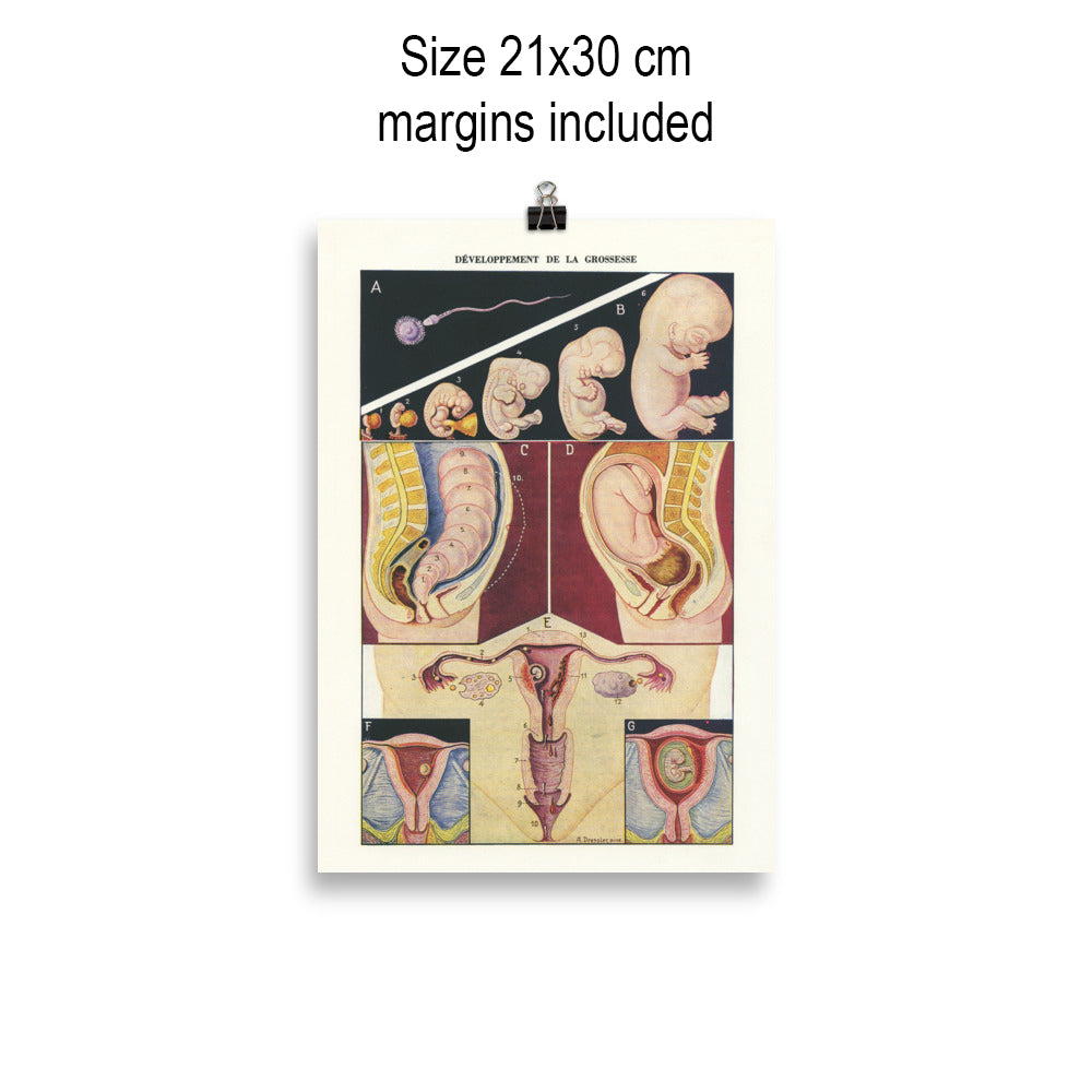 Pregnancy poster for medical doctors, obgyn & midwife gifts.