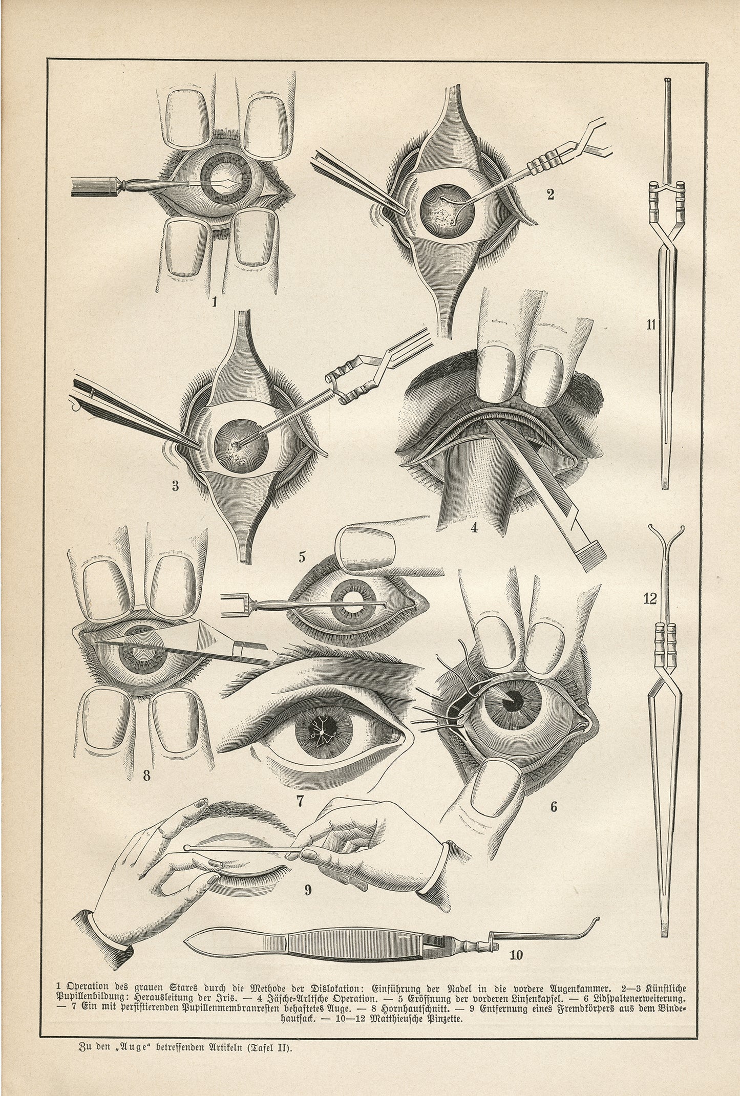 1890 Antique Eye Anatomy Print