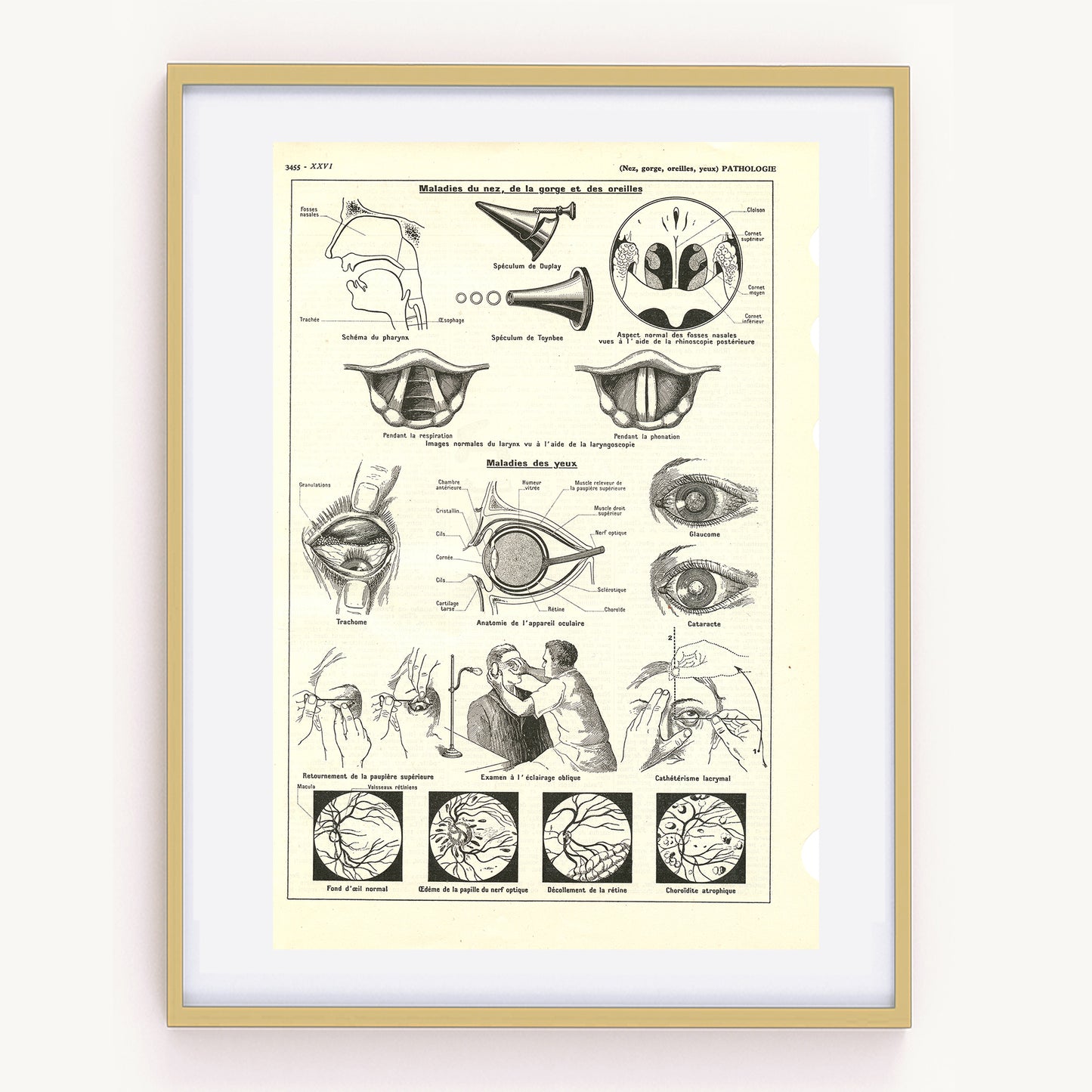 1938 Eye, Nose & Throat  Pathology Anatomy Print