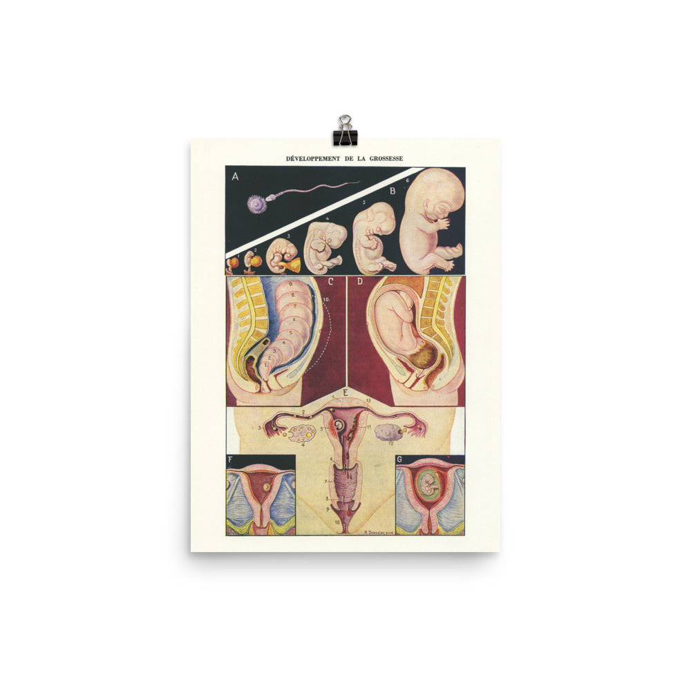 samll pregnancy poster vintage medical print reprint